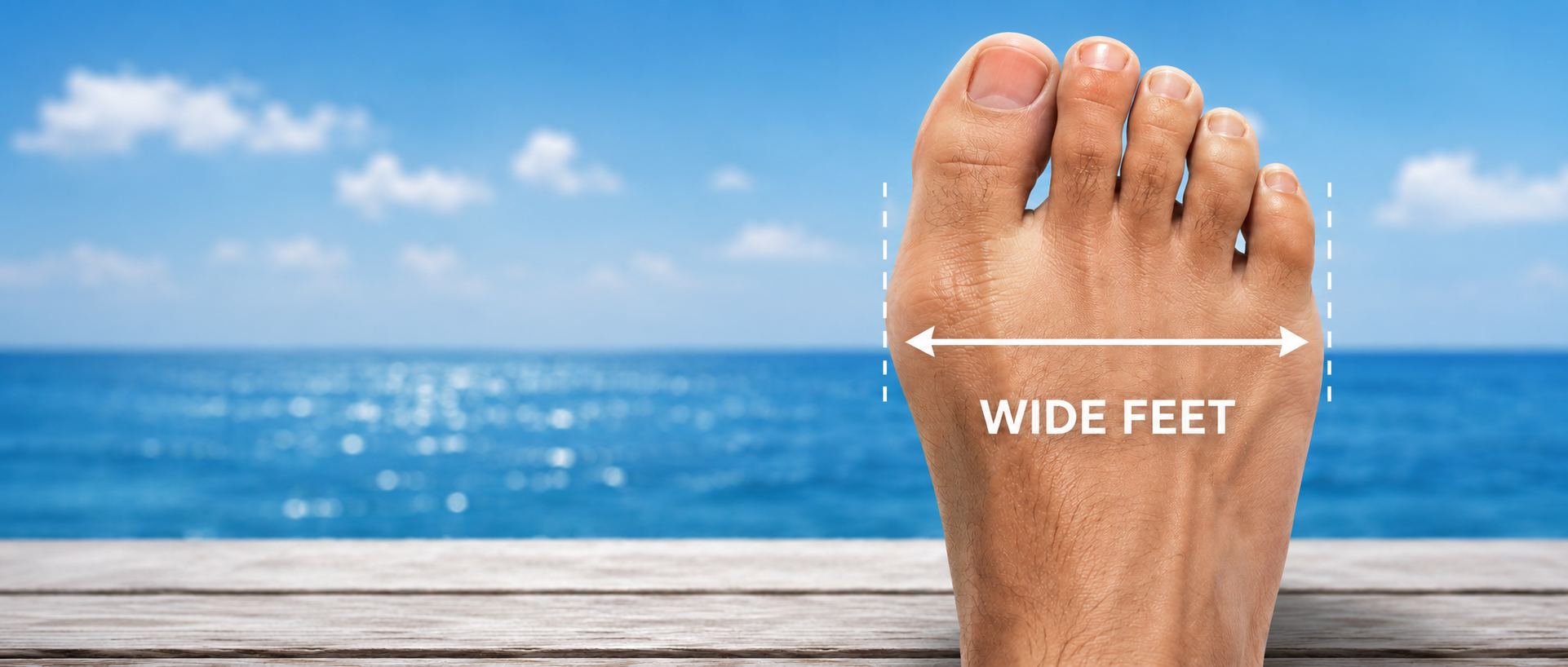 wide feet symptoms