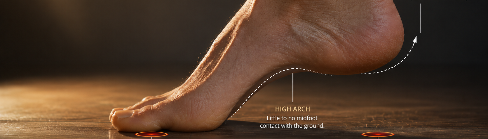 Foot with high arches and supination explanation on a dark background