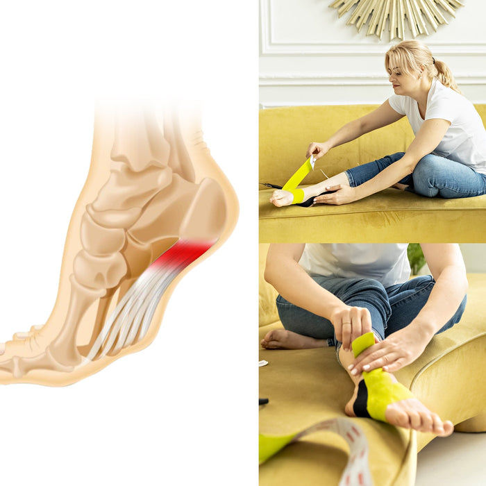 plantar fasciitis treatments​